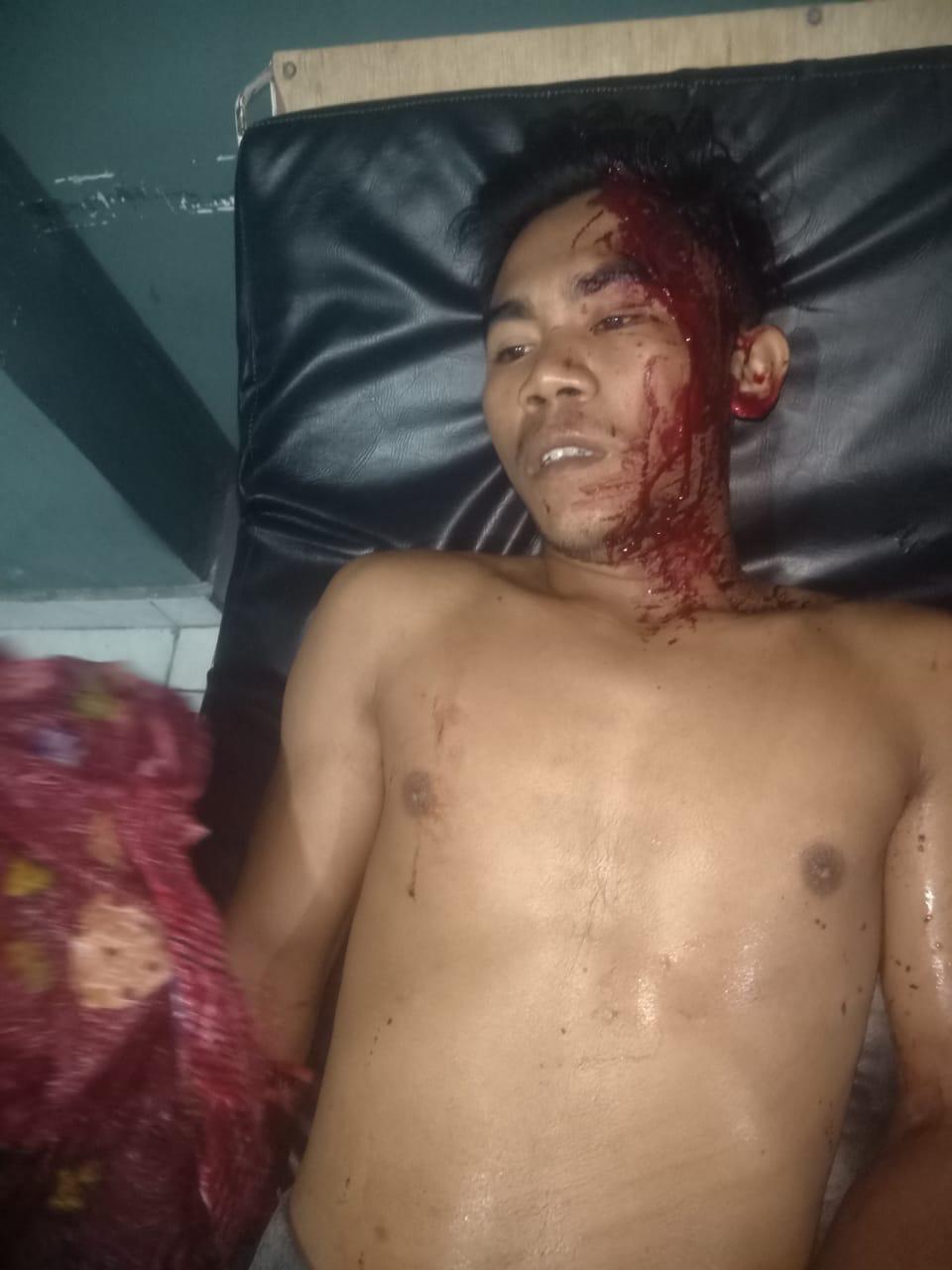 Saudara Kandung di Lombok Timur Saling Tikam Akibat Pengaruh Miras