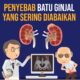 BPOM Rilis Daftar 10 Obat Herbal Berbahaya, Ancam Ginjal dan Jantung
