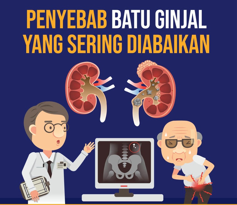 BPOM Rilis Daftar 10 Obat Herbal Berbahaya, Ancam Ginjal dan Jantung