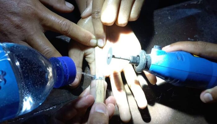 Cincin Terjepit di Jari, Petugas Pemadam Kebakaran Lombok Barat Sukses Lepaskan