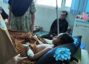 Bocah 4 Tahun di Lombok Timur Diserang Anjing Liar, Alami Luka Parah