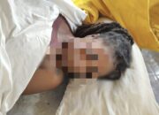 Geger Gili Air: WNA Prancis Meninggal Dunia Diduga Gantung Diri