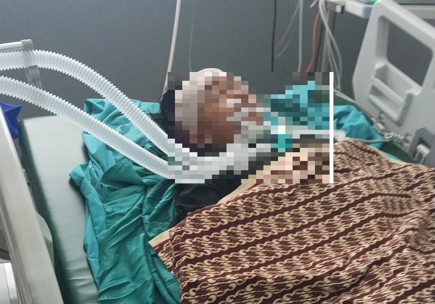 Pembacokan 3 Remaja di Mataram, Mohan Minta Pelaku Diburu